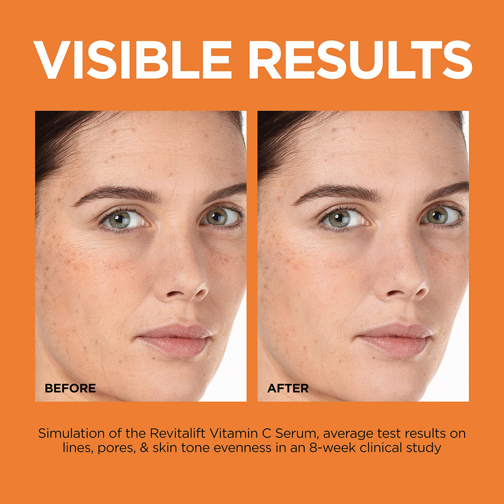 Vitamin C Brightening Face Serum with Vitamin E, Salicylic Acid, 1 oz J7333